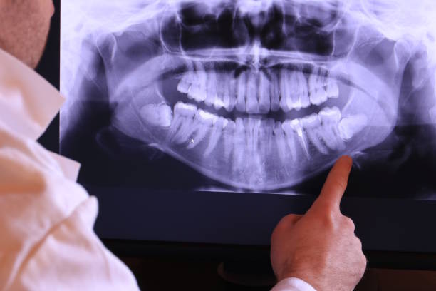 Best Emergency Cosmetic Dentistry in Elmwood Park, NJ